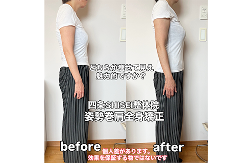 ビフォーアフター