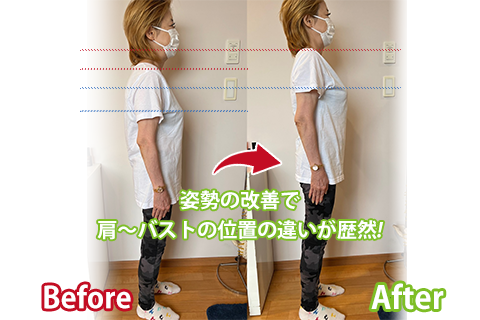 ビフォーアフター画像