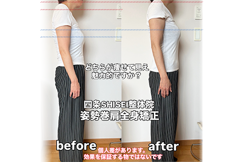 ビフォーアフター